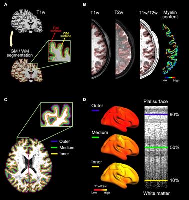 Linking Plasma Amyloid Beta and Neurofilament Light Chain to Intracortical Myelin Content in Cognitively Normal Older Adults